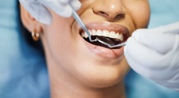 Professional Emergency Dentist in MS